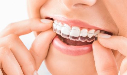 Invisible Braces Vs. Traditional Braces: Which Is Right for You?